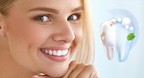 Radiant Whitening Toothpaste