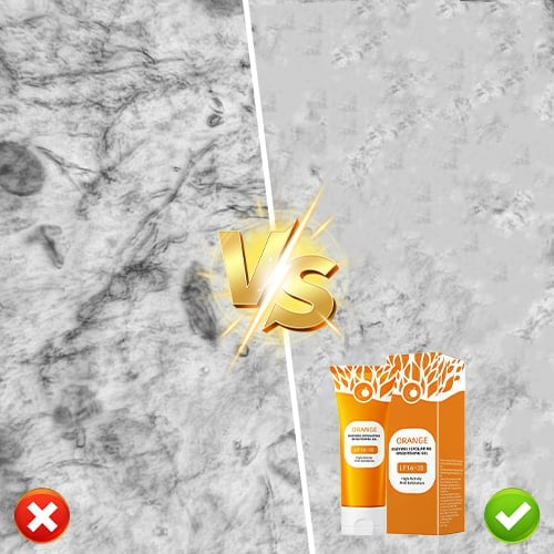 Orange Enzyme Exfoliating Gel 50g – Facial Cleansing Peel