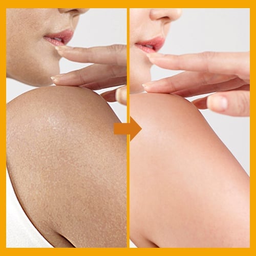 Orange Enzyme Exfoliating Gel 50g – Facial Cleansing Peel